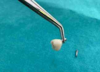 Harvat etsivät Kelan tukemaa ulkomaista terveydenhoitoa news-05102024-153041