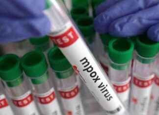 Miten tunnistaa aggressiivinen m-rokkotautimuoto Yhdysvalloissa news-17112024-061222