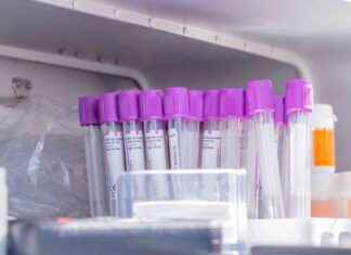 Vertailu: Lukijoiden mielipiteet verenluovutuksesta vertailu-lukijoiden-mielipiteet-verenluovutuksesta